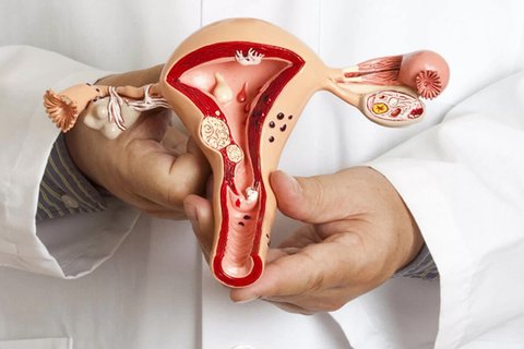 Миома матки